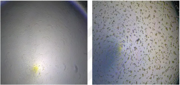 Şekil 4.1. HSV-1 ile enfekte olmamış (solda) ve enfekte olmuş (sağda) Vero hücrelerinin  görünümü (Orijinal) 