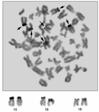 Fig 3. Silver-stained metaphase spread and positive chromosomes  of  Lepus europaeus from İçel