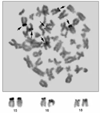 Fig 3. Silver-stained metaphase spread and positive chromosomes  of  Lepus europaeus from İçel