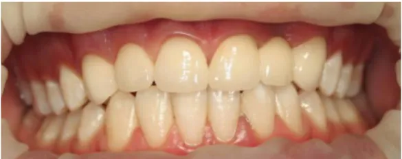 Figure 4: Post-operative treatment of the patient 