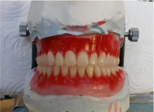 Figure 2. Teeth position and occlusion. 