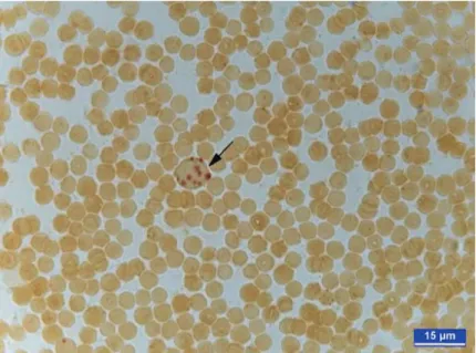Fig 1. An ANAE-positive peripheral blood lymphocyte in  animal from control group ANAE demonstration