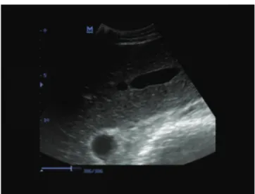 Fig 3. Ultrasonogram of liver of healthy a cow Şekil 3. Sağlıklı bir inekte karaciğer ultrasonogramı
