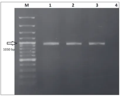 Fig 1. The results of the amplification of F gene region. M: 100 bp DNA ladder,   1: Positive control; 2,3,4: Positive samples