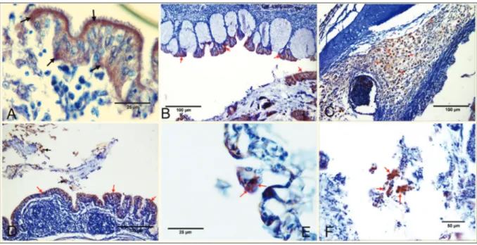 Fig 3. A. Trachea. Positive immunostaining in the mucosal epithelia (arrows), IHC, B. Larynx