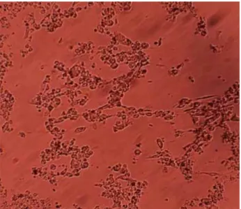 Figure 1. CPE after 72.h post-inoculation (X40). Figure 2. CPE after 120.h post-inoculation (X40).