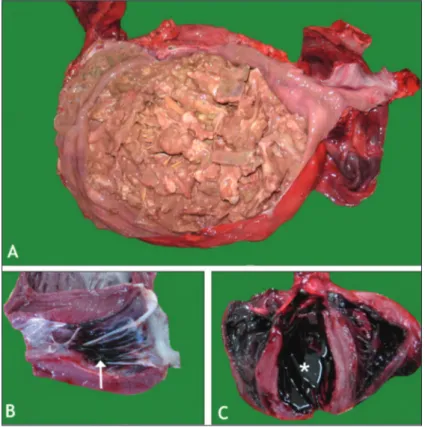 Fig 1. A) Undigested pieces of chicken in stomach, B) Endocardial haemorrhages  (arrow), C) Semi-clotted blood in ventricle (asterisk)