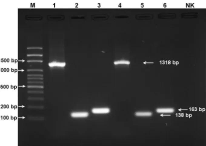 Şekil 1. PZR ürünlerinin agaroz jel elektroforez görüntüsü. M: 100 bp DNA  marker, 1: S