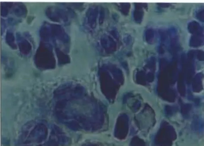 Şekil 5. Bir koyunda GPTS'in inlerlobuler in- in-tersitisyumundaki plazma hücreleri görülmekte