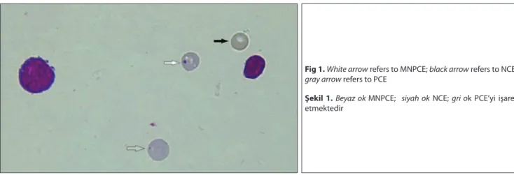 Fig 1. White arrow refers to MNPCE; black arrow refers to NCE; 