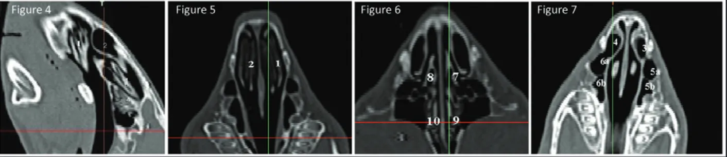 Figure 4. Sagittal MDCT view of paranasal sinuses. 1: Left ventral nasal concha, 2: Left dorsal nasal concha, 3: Left middle nasal concha, 4: Left  endoturbinalia.