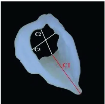 Figure 1. Locations of measurements taken from thyroid cartilage.