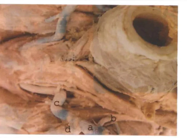Şekil 3: V. linguefacialis ve v, lingualis (Ventral)