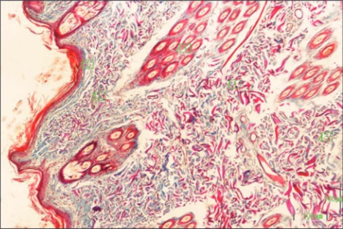 Figure 1. Vertical sections of skin of the chinchilla. 1:Epidermis, 2- 4-  5: Collagen fibres in dermis,  3: Hair follicles