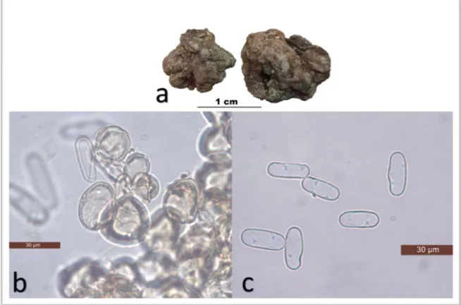 Figure 1: a; Ascocarps, b; Peridial cells, c; Ascospores. 