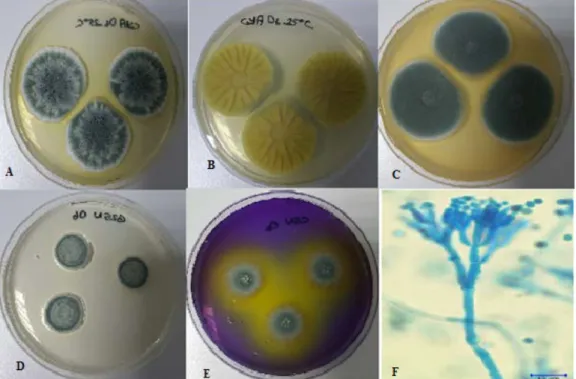 Figure 2.  P. chrysogenum A. CYA medium, at 25°C, colonial morphology for seven days. B