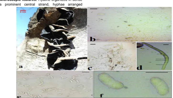 Figure 2. Auricularia nigricans. (a);The fruiting body of fungi (b); Mycelium, Hyphae a tubular filament growing and new  hyphae form by branching