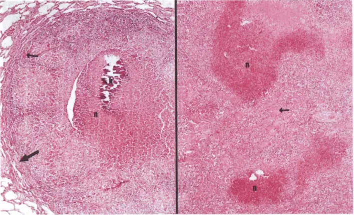 Şekil  3.  Akciğer. Tipik bir tüberkülde,  ortada  kireçlenme (k),  kazeilasyon  nekrozu  (n),  çevrede  epileloid,  mononükleer ve  Langhans  tipi  dev hücreleri  (ince  ok)  ile  en  dışta  ince  bir  fibröz  kapsül  (kalın  ok)