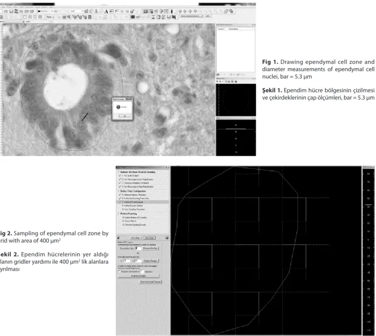 Fig 1. Drawing ependymal cell zone and  diameter measurements of ependymal cell  nuclei, bar = 5.3 µm