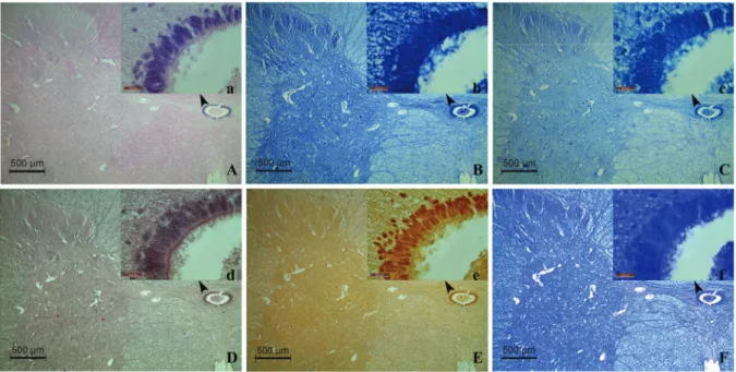 Fig. 3. Cross-sectional images obtained by 4× and 100× objectives under a light microscope (A: H&amp;E, B: MMGG, C: MGG, D: MT, E: AgNORs,  F: KB; Upper-case letter: 4×, Lower-case letter: 100×)