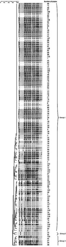 Figure 1. PGFE XbaI digestion patterns and clonal analysis of  120 ESBL-producing E. coli isolates (2017-2019) (1-120)
