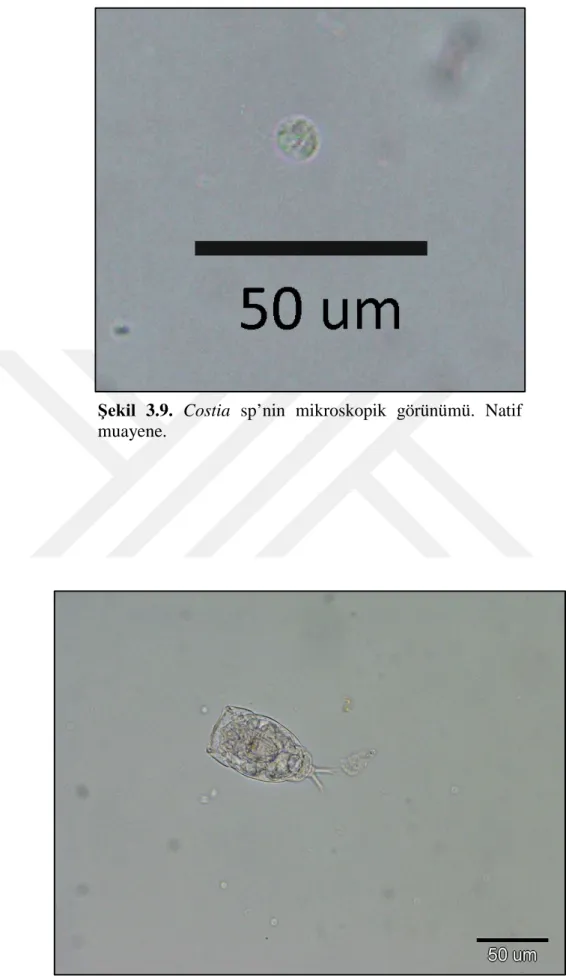 Şekil  3.10.  Rotifera  sp (Euglanis  sp)’nin mikroskopik görünümü. 