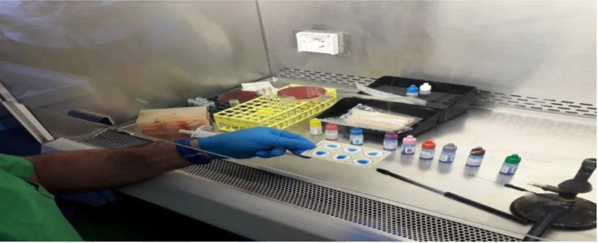 Figure 2.3. The detection of group C Streptococci by Lancefield grouping (Latex  method)