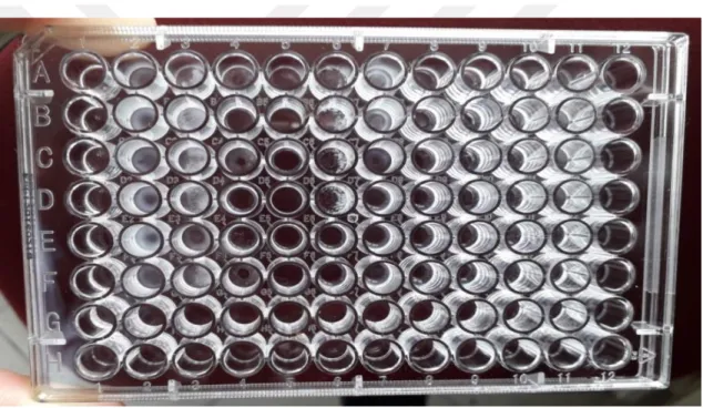 Figure 2.9.  No biofilm have formed by the negative control number (1) while we can  notice the variation in the degree of the adhered biofilm material formed by the different  cultured strains from 2 to 11.