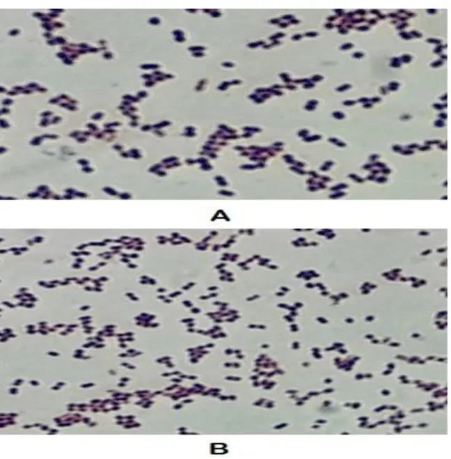 Figure  3.1.  Streptococcus  zooepidemicus  under  the  microscope  using  100x  magnification