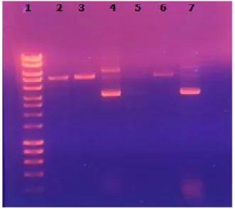 Şekil  1.  Restriksiyon enzimleri ile kesim  1)DNA Ladder 2)pTZ57RT+BamHI  3)pTZ57RT+XhoI  4)pTZ57RT 5)pET28a+BamHI  6)pET28a+XhoI 7)pET28a 