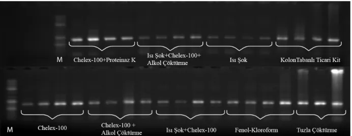 Şekil 2. ITS2 bölgesine ait PCR ürünlerin %1’lik agaroz jel üzerindeki görüntüsü gösterilmiştir