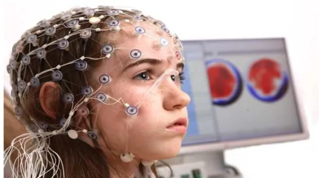 Şekil 6: EEG Çekimi 