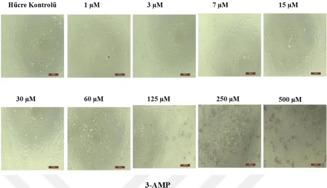 Şekil 4.3. 96 kuyu plakalara ekimi yapılmış olan Saos-2 hücrelerine 24 saat sonra 3-AMP’nin etkisinin  10x objektifteki invert mikroskop görüntüleri 