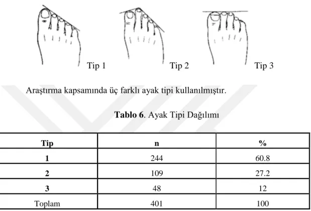 Tablo 6. Ayak Tipi Dağılımı 