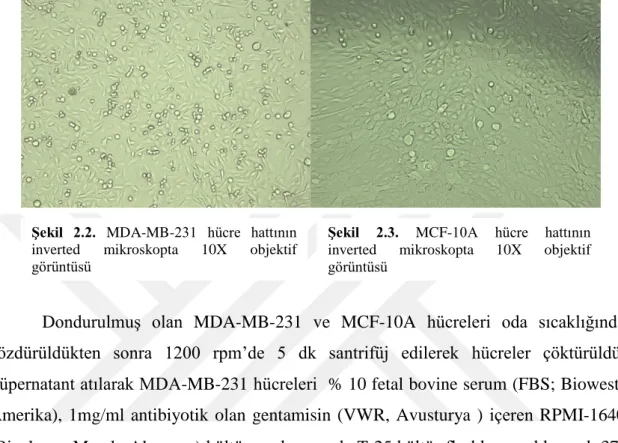 Şekil  2.2.  MDA-MB-231  hücre  hattının  inverted  mikroskopta  10X  objektif  görüntüsü  