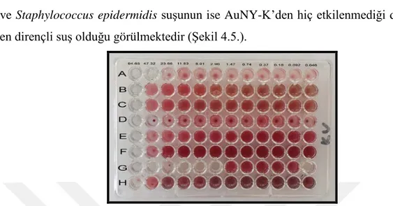 Şekil 4.5. AuNY-K antimikrobiyal sonuçları