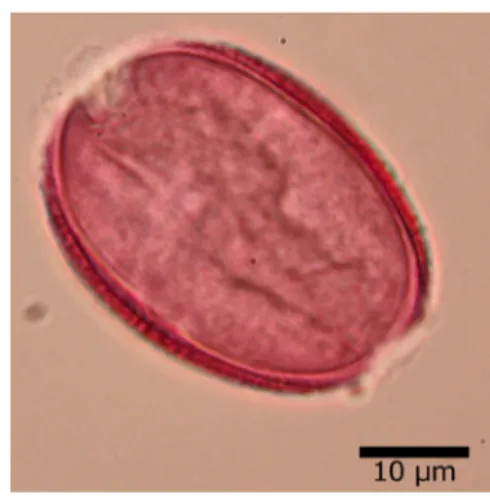 Şekil  4.14.  Hyacinthella campanulata K.Perss.&amp;  Wendelbo  taksonunun  ışık  mikroskobunda  çekilen resimi 