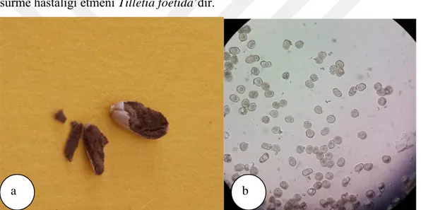Şekil 4.1. a)Tilletia foetida ile enfektelibuğday daneleri ve b) klamidiosporlarının mikroskobik görünümü  