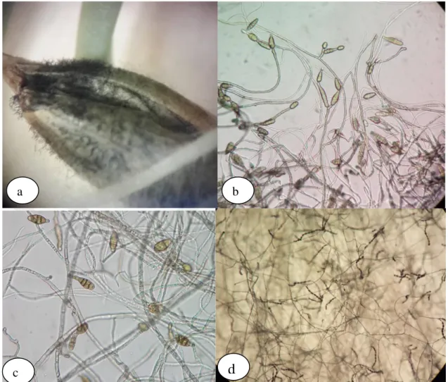 Şekil 4.2. a) Altrnaria  sp.  arpa tohumu üzerindeki miseliyal gelişimi, b ve c)konidiosporlarının  mikroskobik görüntüsü ve c) sreteriomikroskop görüntüsü  