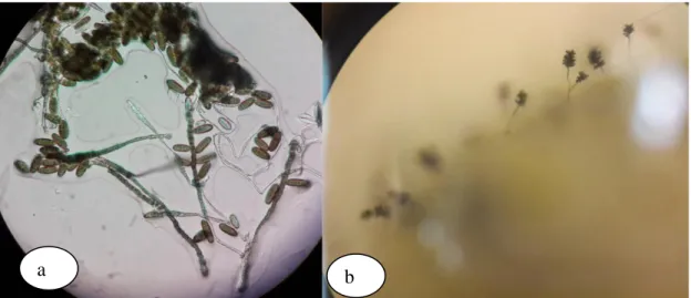 Şekil 4.10. Cocoliobolus sp., a) Mikroskop görüntüsü, b) Stereomikroskop ta tohum üzerinde ki  görüntüsü 