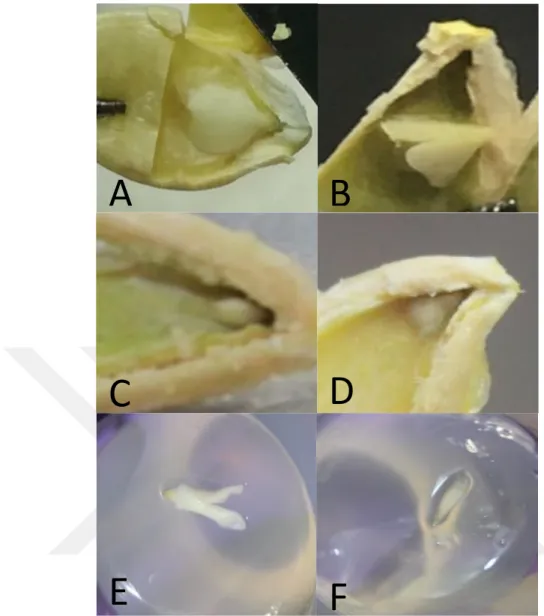 ġekil 3.2.7. Farklı embriyo tipleri (A-kotiledon, B-yürek, C-nokta, D-globüler, E-torpedo, F-okucu) 