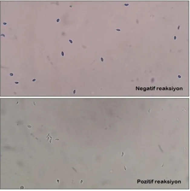 Şekil  10.  Sabin-Feldman  boya  testinde  kaydedilen  pozitif  ve  negatif  reaksiyonlar 