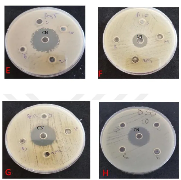 Şekil  4.2.2:  72  saatlik  EcN  probiyotik  bakteri  suşu  kültüründen  santrifüj  yapılarak  elde  edilen  süpernatantın  10  ve  20  kat  yoğunlaştırılıp  kullanılarak  yapılan  denemeye  ait  bazı  plakların  görümü
