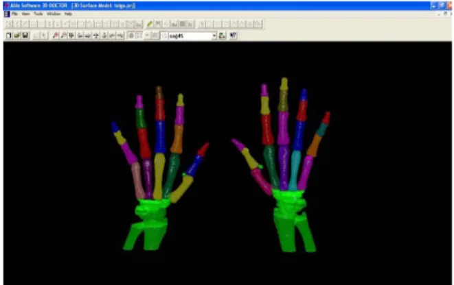 Figure	  1.	  Manual	  determination	  of	  the	  limits	  in	  the	  working	   area	  of	  2D	  image	  (Kalaycı,	  2008).	  