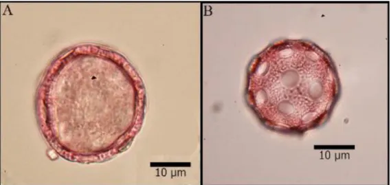 Figure 10. The light microscope (LM) photographs of Silene tunicoides A. The general view of pollen B