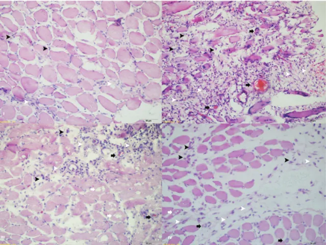 FIGURE 3. Histomorphometric evaluation staining with H&amp;E. I: Muscle organization, mononuclear cell infiltration in some endomysium and perimysium layers with poor muscle organization (black arrowheads) and few fibrotic changes (white arrowheads) in G1