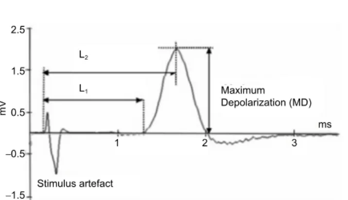 Figure 1 Demonstration of the measurement parameters on a  sample recording of the compound action potentials.