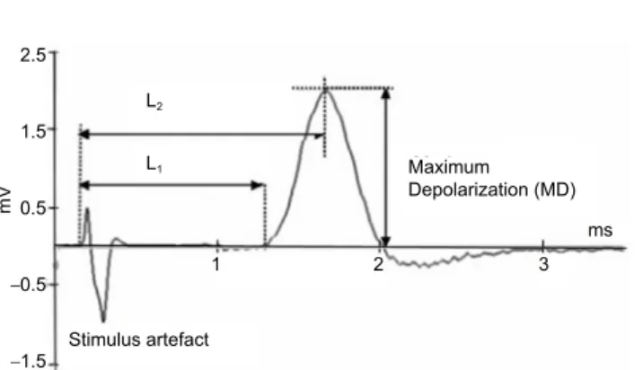 Figure 1 Demonstration of the measurement parameters on a  sample recording of the compound action potentials.