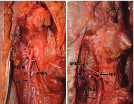 Fig. 4. Origin, course, and branches of the first recurrent epiphyseal artery and sec- sec-ond recurrent epiphyseal artery in two left specimens