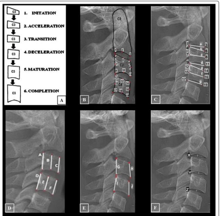 Fig. 1 The cervical vertebral references and measurements. a The observed alteration of C3
